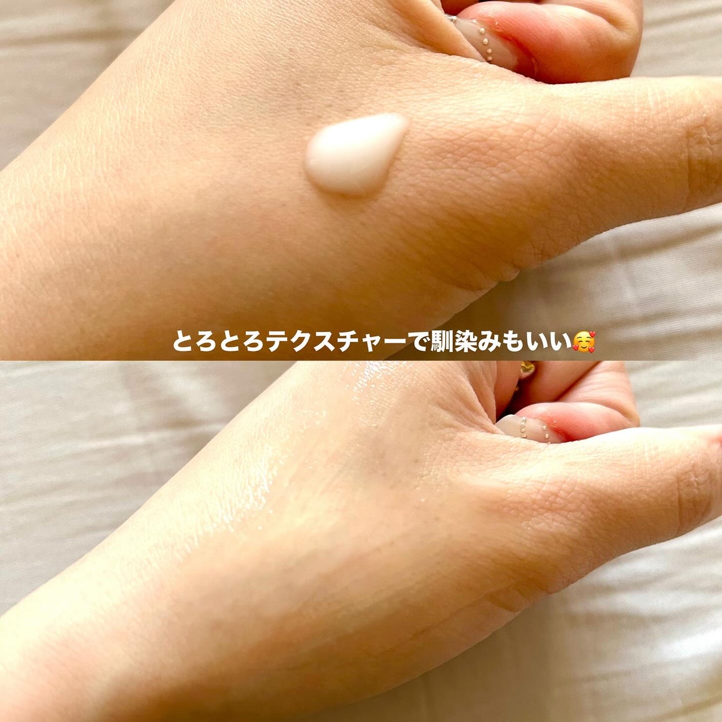 プロバイオシカ インテンシブ アンプル/SKIN1004/美容液を使ったクチコミ(4枚目)