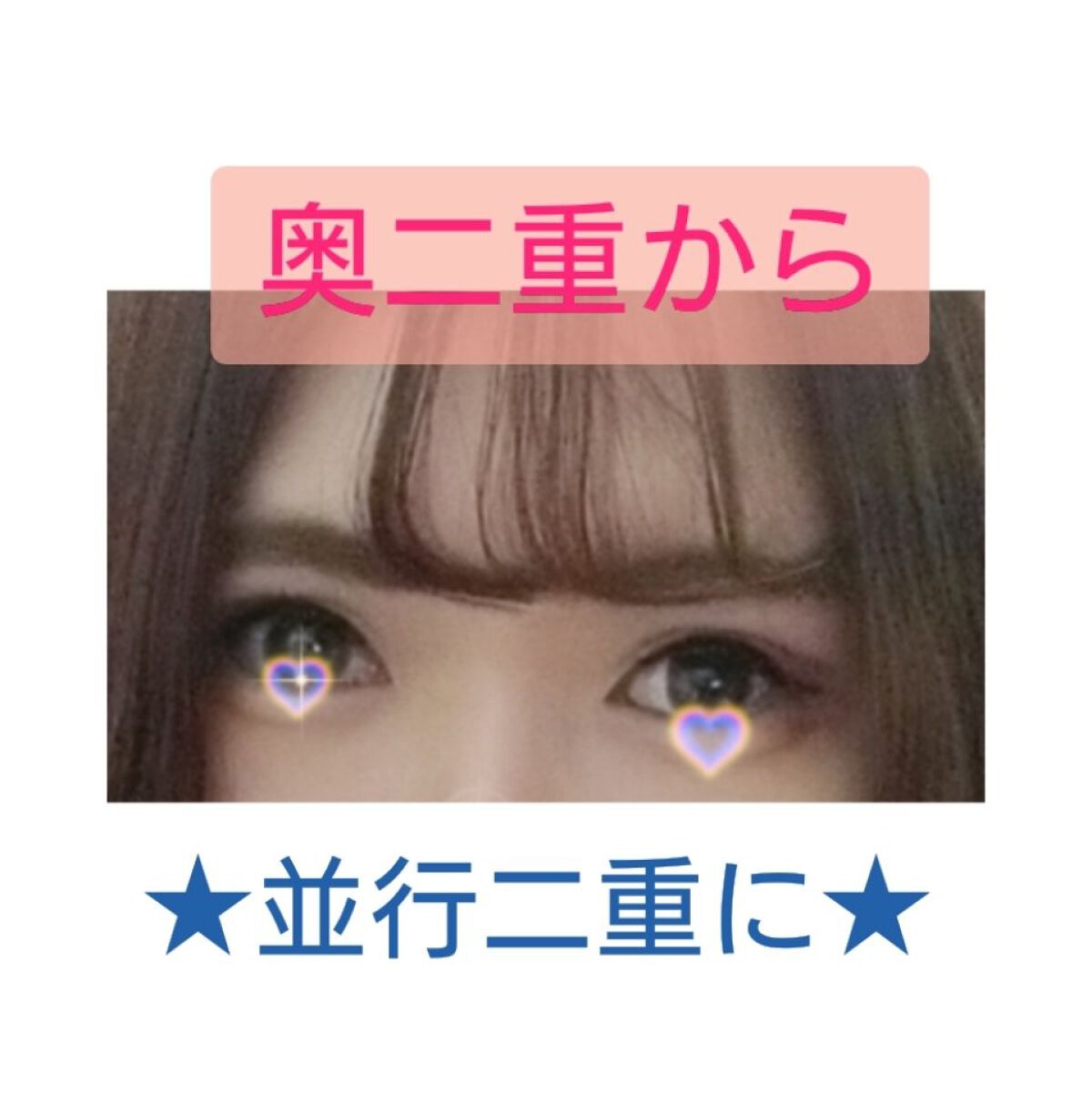 シングルアイテープ/Automatic Beauty/二重まぶた用アイテムを使ったクチコミ（3枚目）