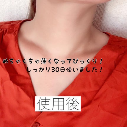 プレミアムナイテ スレッドネッククリーム/MEDIPEEL/ネック・デコルテケアを使ったクチコミ(4枚目)