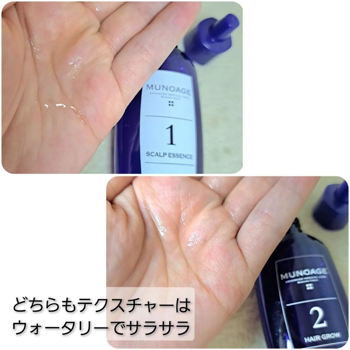 Wアプローチヘアプログラム/MUNOAGE(ミューノアージュ)/頭皮ローションを使ったクチコミ(3枚目)