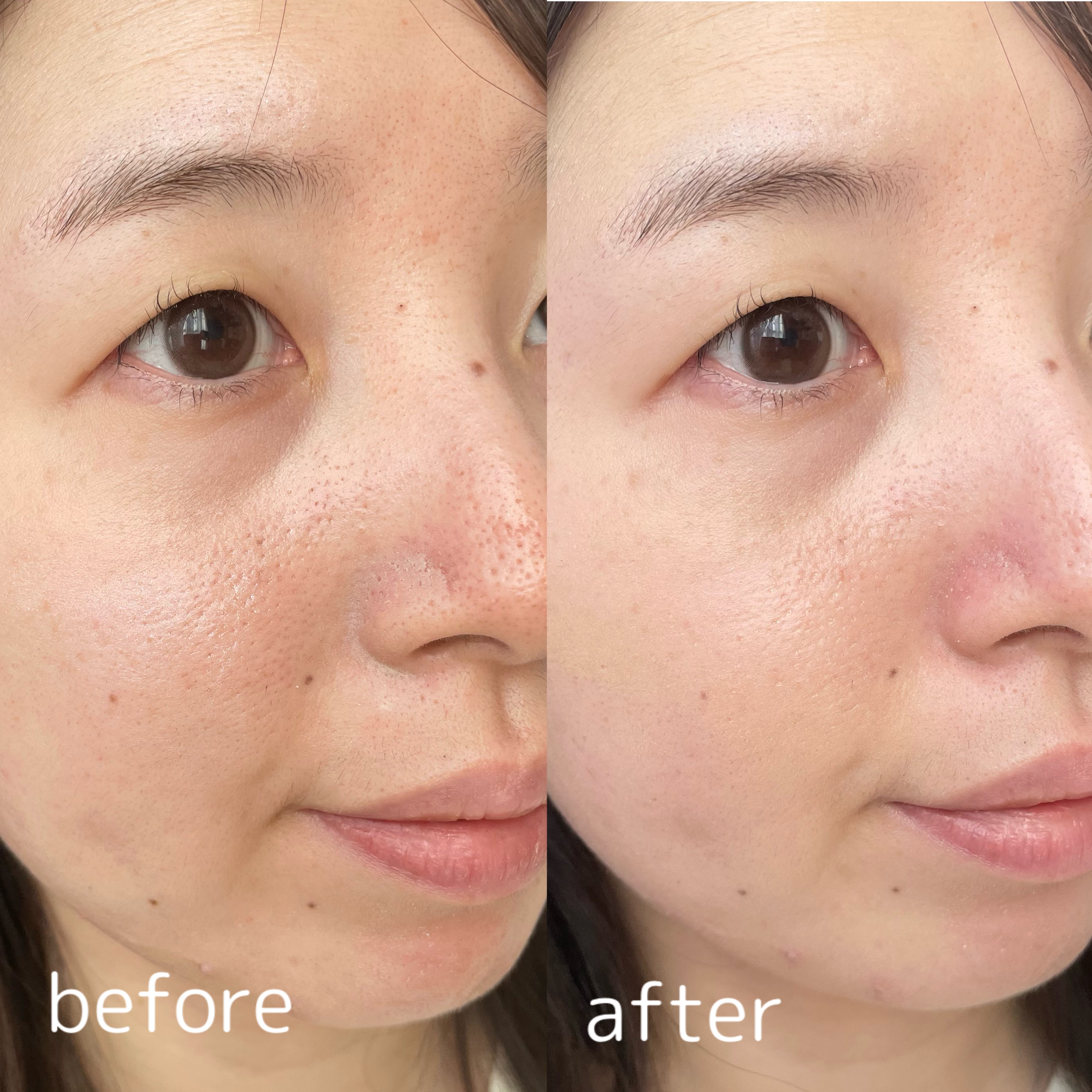 SPステイ ルミマット リキッド ファンデーション/MAYBELLINE NEW YORK/リキッドファンデーションを使ったクチコミ（3枚目）