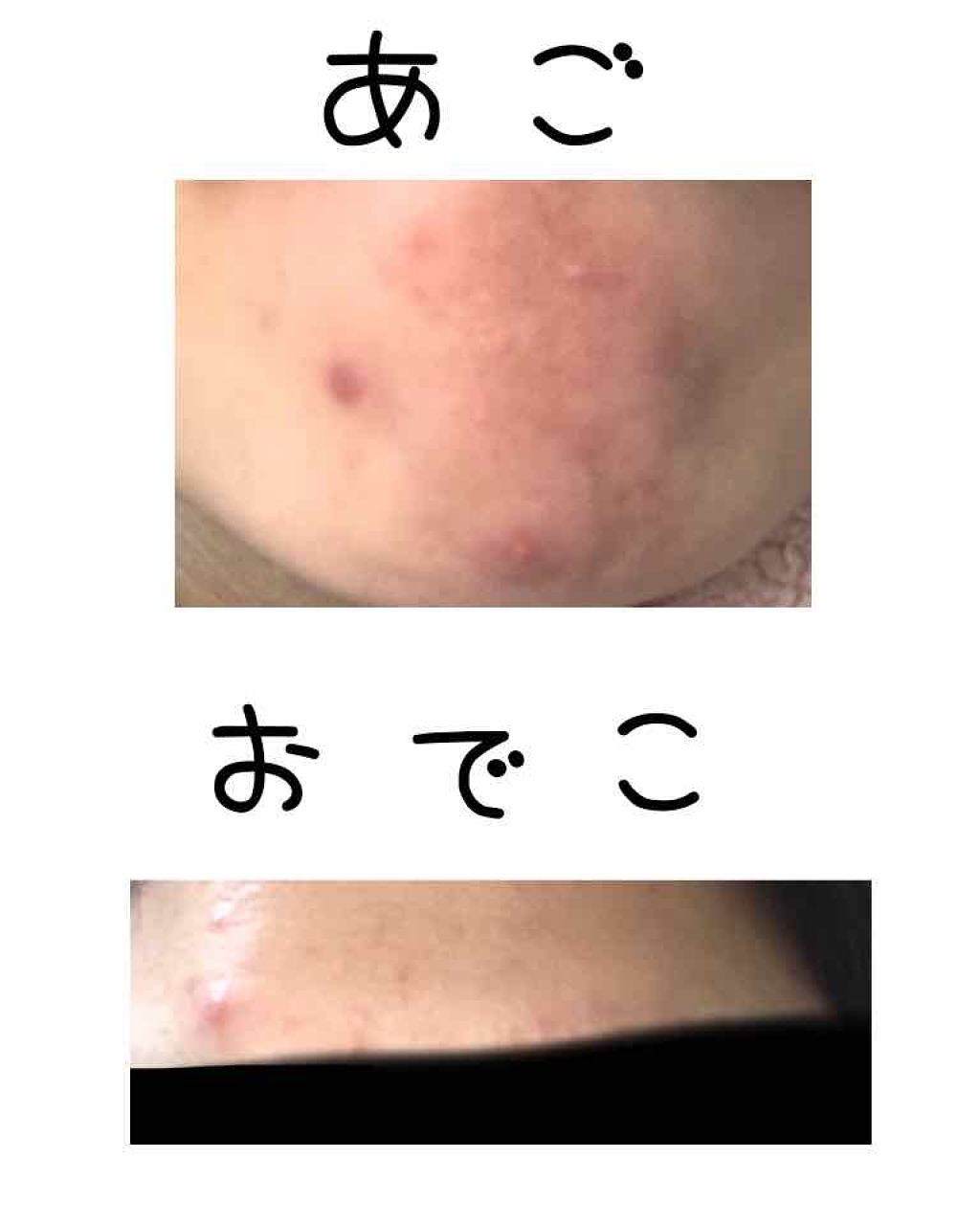 ハトムギ化粧水(ナチュリエ スキンコンディショナー R )/ナチュリエ/化粧水を使ったクチコミ（2枚目）