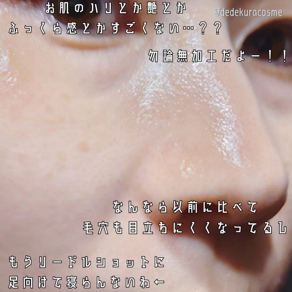 リードルショット100/VT/美容液を使ったクチコミ(4枚目)