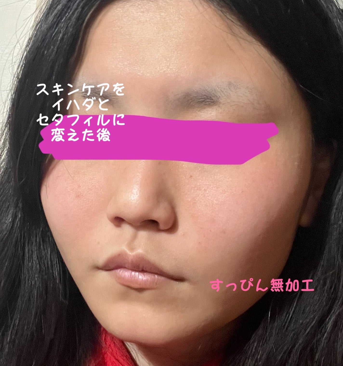 モイスチャライジング クリーム/セタフィル/ボディクリームを使ったクチコミ(4枚目)