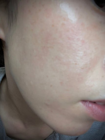 クリアアップ ファンデーション/lujo/クリーム・エマルジョンファンデーションを使ったクチコミ(3枚目)