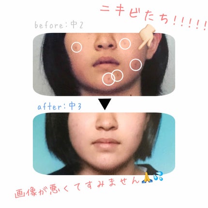 薬用ウォッシュ クリア/ホワイティシモ/洗顔フォームを使ったクチコミ(2枚目)