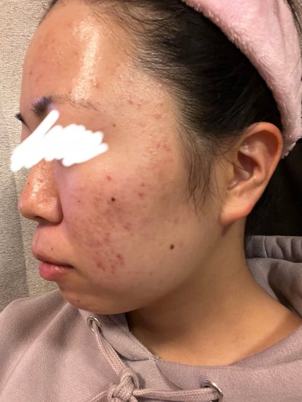 を使ったクチコミ(3枚目)