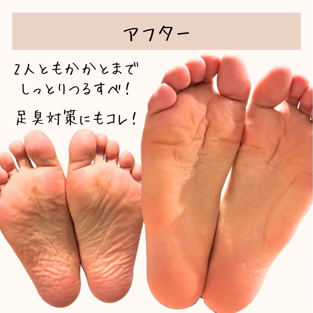 イージーパックDP60分タイプ/ベビーフット/レッグ・フットケアを使ったクチコミ(3枚目)