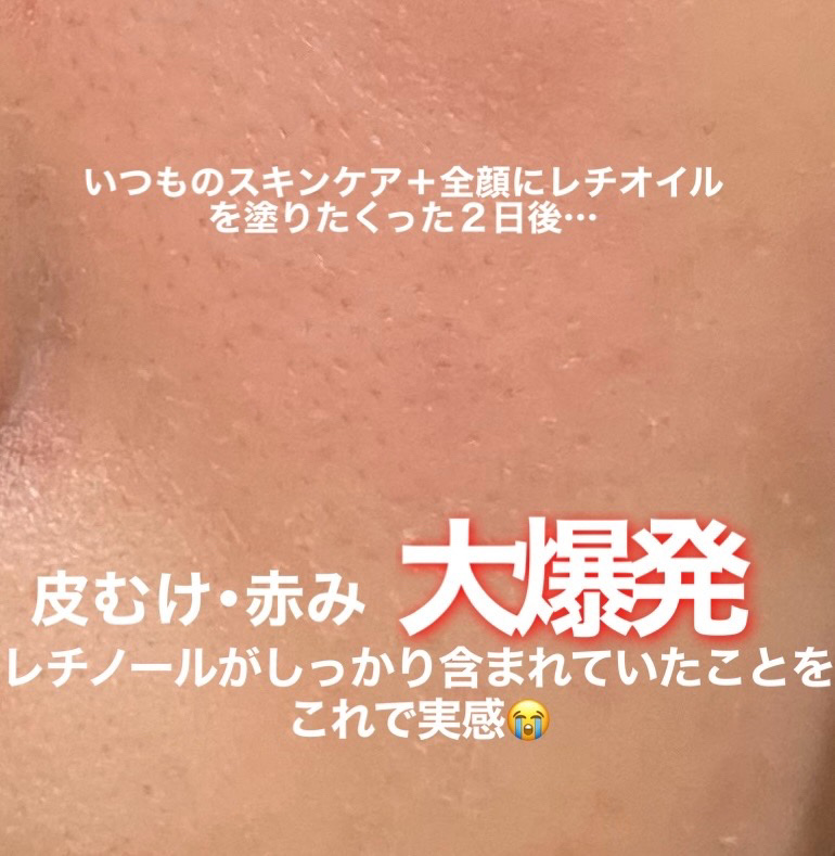 オイルセラム RE/KISO/美容液を使ったクチコミ（3枚目）