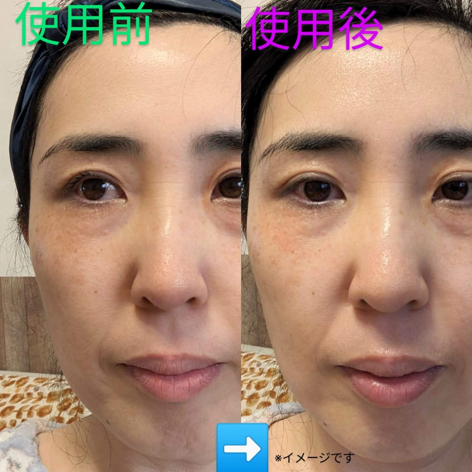 潤エッティモイストマスク/安心健康ライフ/シートマスク・パックを使ったクチコミ（2枚目）