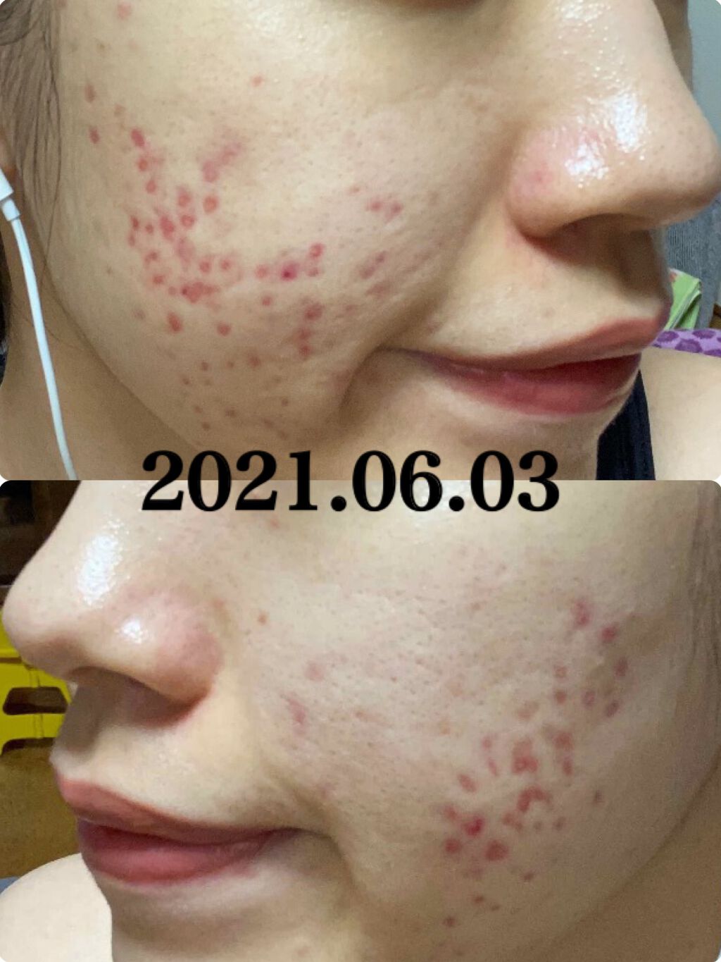 ロゼット 洗顔パスタ 白泥リフト/ロゼット/洗顔フォームを使ったクチコミ(5枚目)