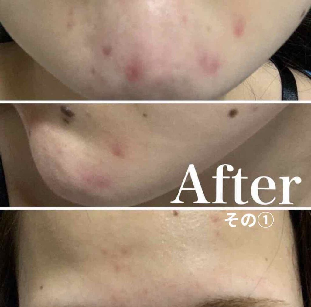 明色美顔水 薬用化粧水/美顔/化粧水を使ったクチコミ（3枚目）