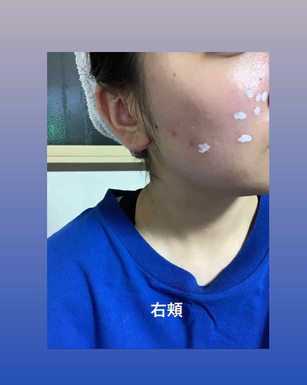 S.O.S スポットパウダー/VELY VELY/その他スキンケアを使ったクチコミ（2枚目）