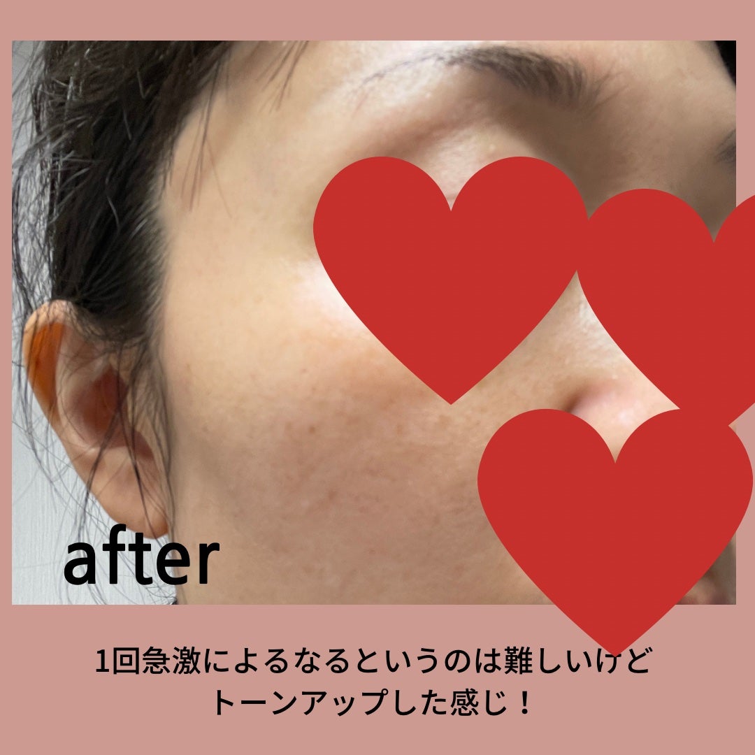 バイオ コンディショニング エッセンス/IOPE/ブースター・導入液を使ったクチコミ(5枚目)