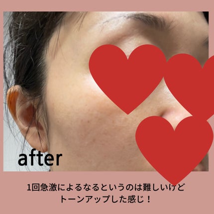 バイオ コンディショニング エッセンス/IOPE/ブースター・導入液を使ったクチコミ(5枚目)