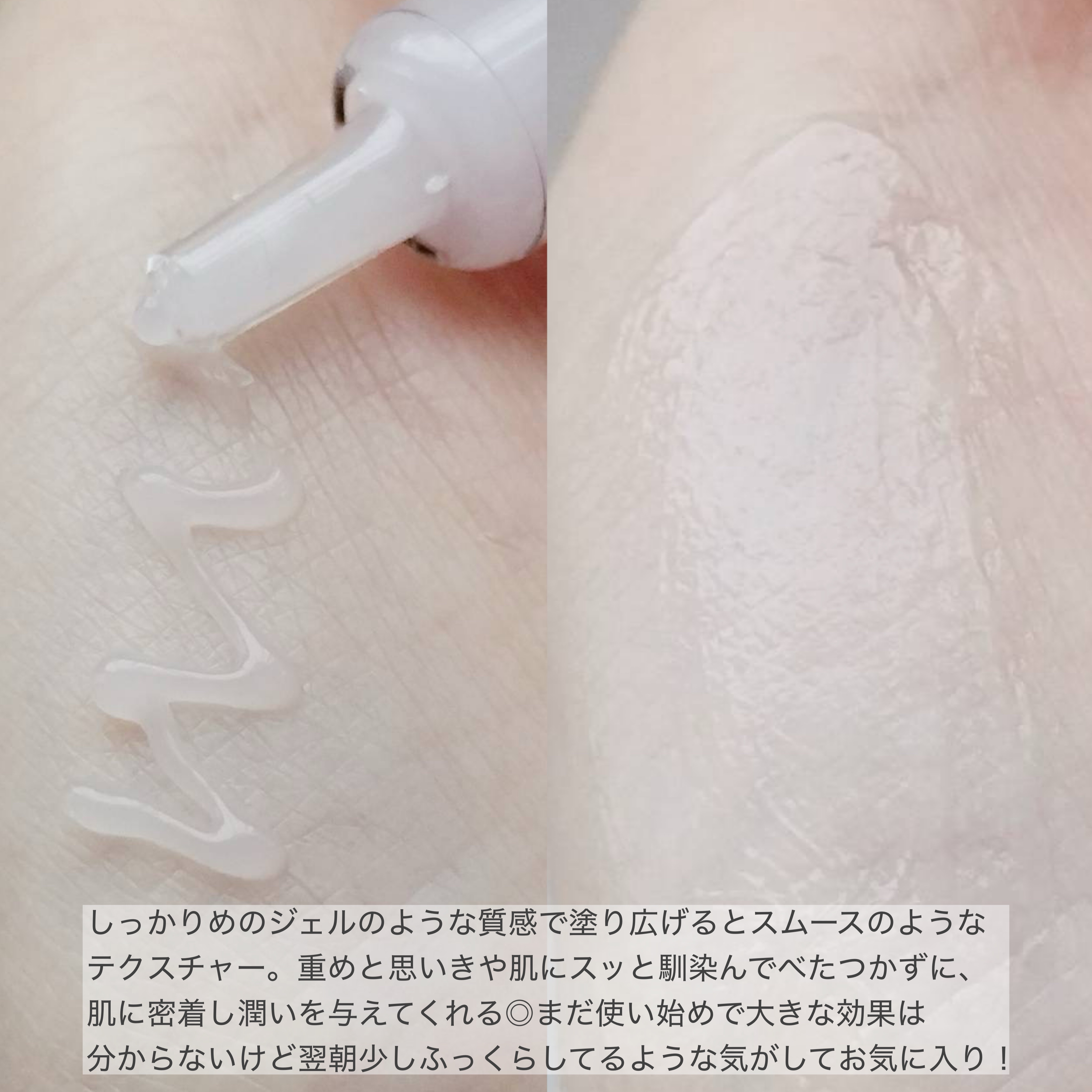 ビトック フォー デイリー RX/Differ&Deeper/美容液を使ったクチコミ（3枚目）