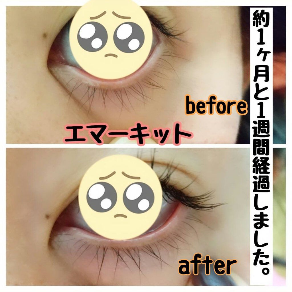 EMAKED（エマーキット）/水橋保寿堂製薬/まつげ美容液を使ったクチコミ（2枚目）