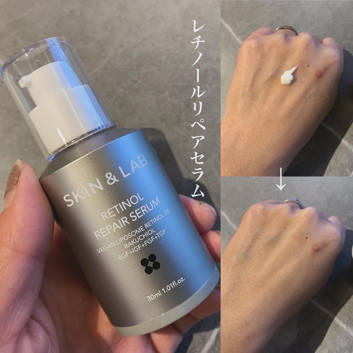 ヴィーガンリポソームレチノールセラム/SKIN&LAB/美容液を使ったクチコミ(2枚目)