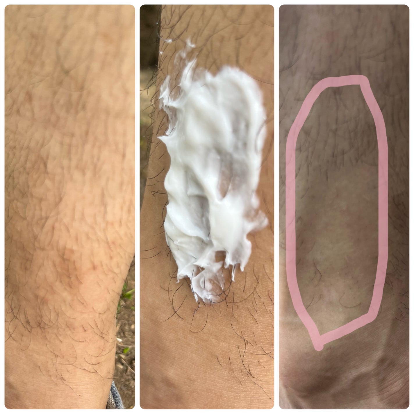 deleMO/deleMO/除毛クリームを使ったクチコミ(3枚目)