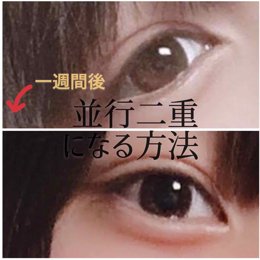 ワンダーアイリッドテープ Extra/D-UP/二重まぶた用アイテムを使ったクチコミ（1枚目）