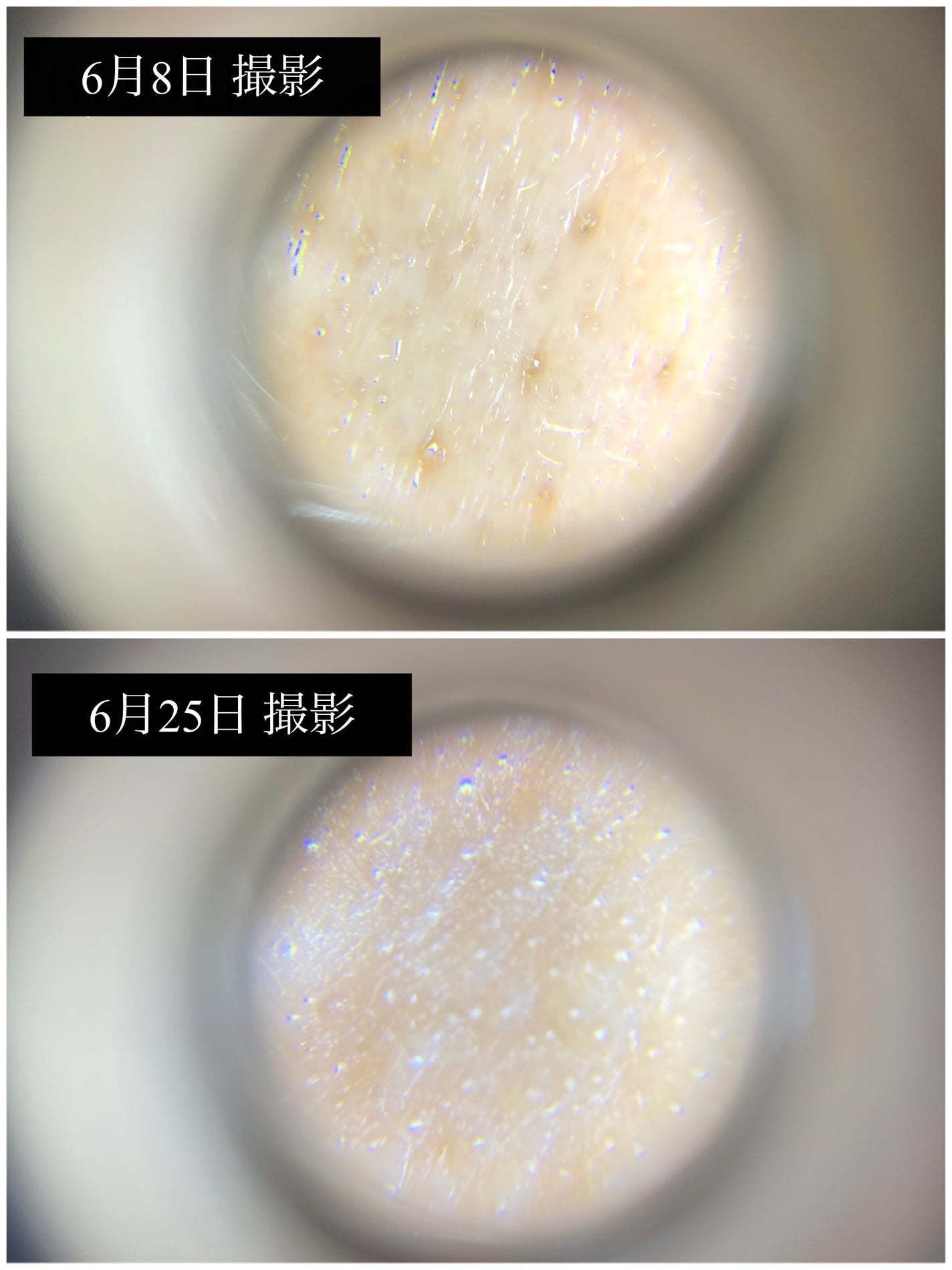 シカレチA エッセンス0.1/VT/美容液を使ったクチコミ(2枚目)