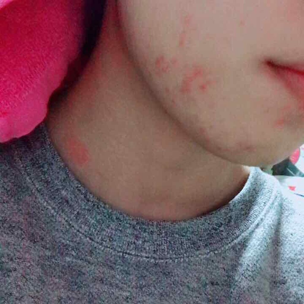 ハトムギ化粧水(ナチュリエ スキンコンディショナー R )/ナチュリエ/化粧水を使ったクチコミ（3枚目）