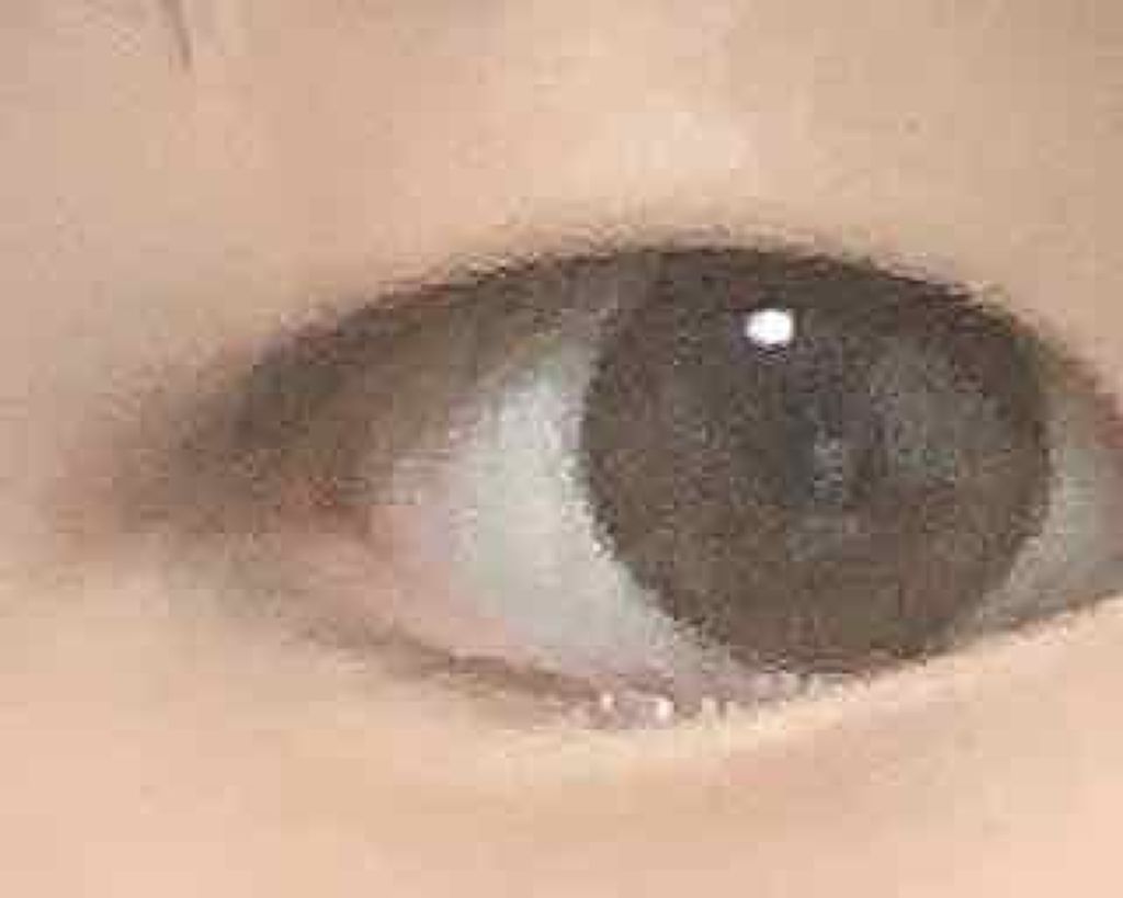 ねむみんご🌾 on LIPS 「この一重特徴ってなんですか?(--;)まぶたが重い一重?なんだ..」(1枚目)