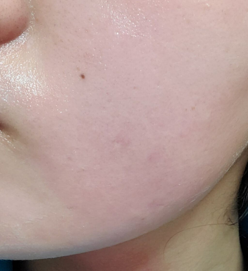 つるすべ除毛パッド/DAISO/ムダ毛ケアを使ったクチコミ（2枚目）