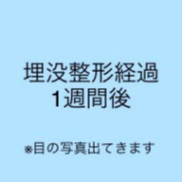 二重整形/その他を使ったクチコミ（1枚目）