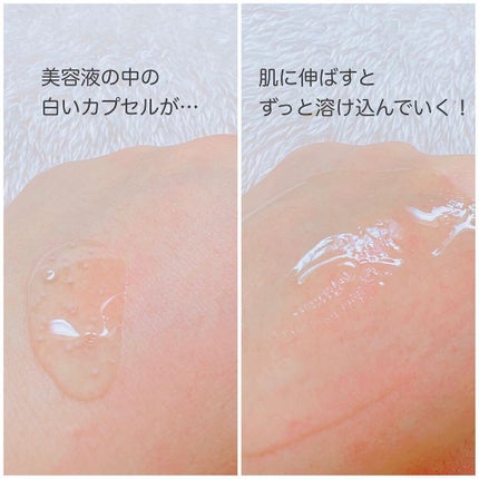 トーンブライトニング カプセルアンプル/SKIN1004/美容液を使ったクチコミ(4枚目)