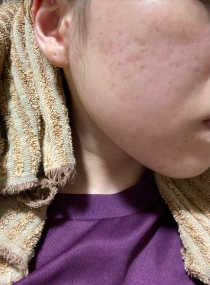 フレッシュリージュースドビタミンドロップ(35ml)/Klairs/美容液を使ったクチコミ(1枚目)