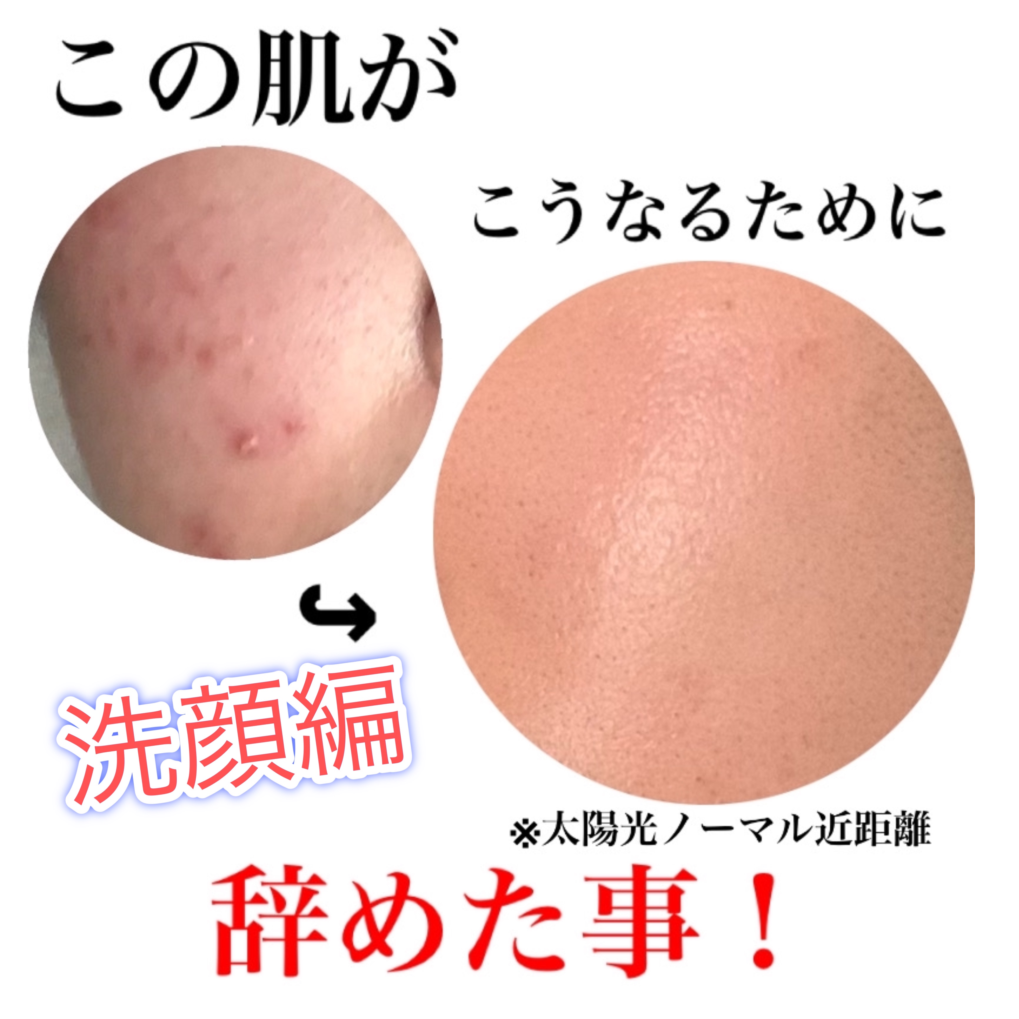 皮脂トラブルケア 泡洗顔料/キュレル/泡洗顔を使ったクチコミ（1枚目）