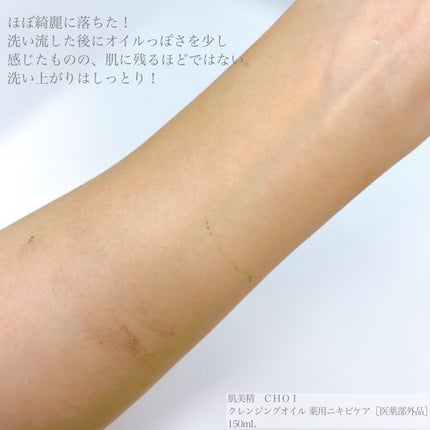 CHOIクレンジングオイル 薬用ニキビケア/肌美精/オイルクレンジングを使ったクチコミ(5枚目)