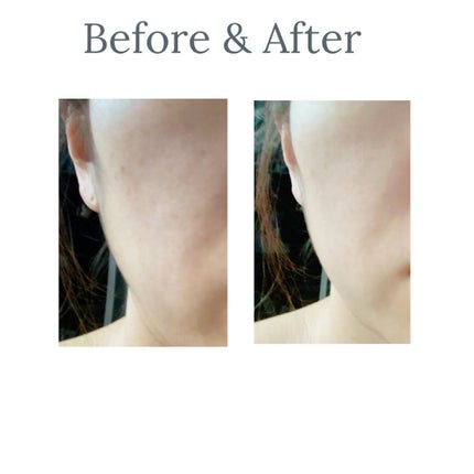 バイオ コンディショニング エッセンス/IOPE/ブースター・導入液を使ったクチコミ(4枚目)