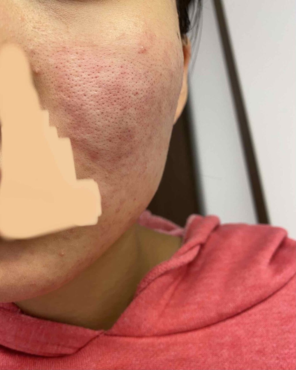 明色美顔水 薬用化粧水/美顔/化粧水を使ったクチコミ(2枚目)