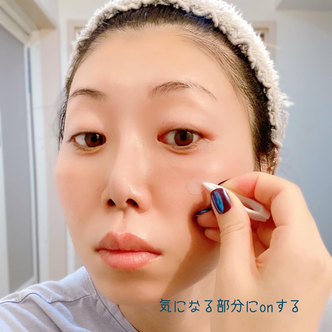 ビューティー スポットパッチ/イージーダムビューティー/にきびパッチを使ったクチコミ(5枚目)