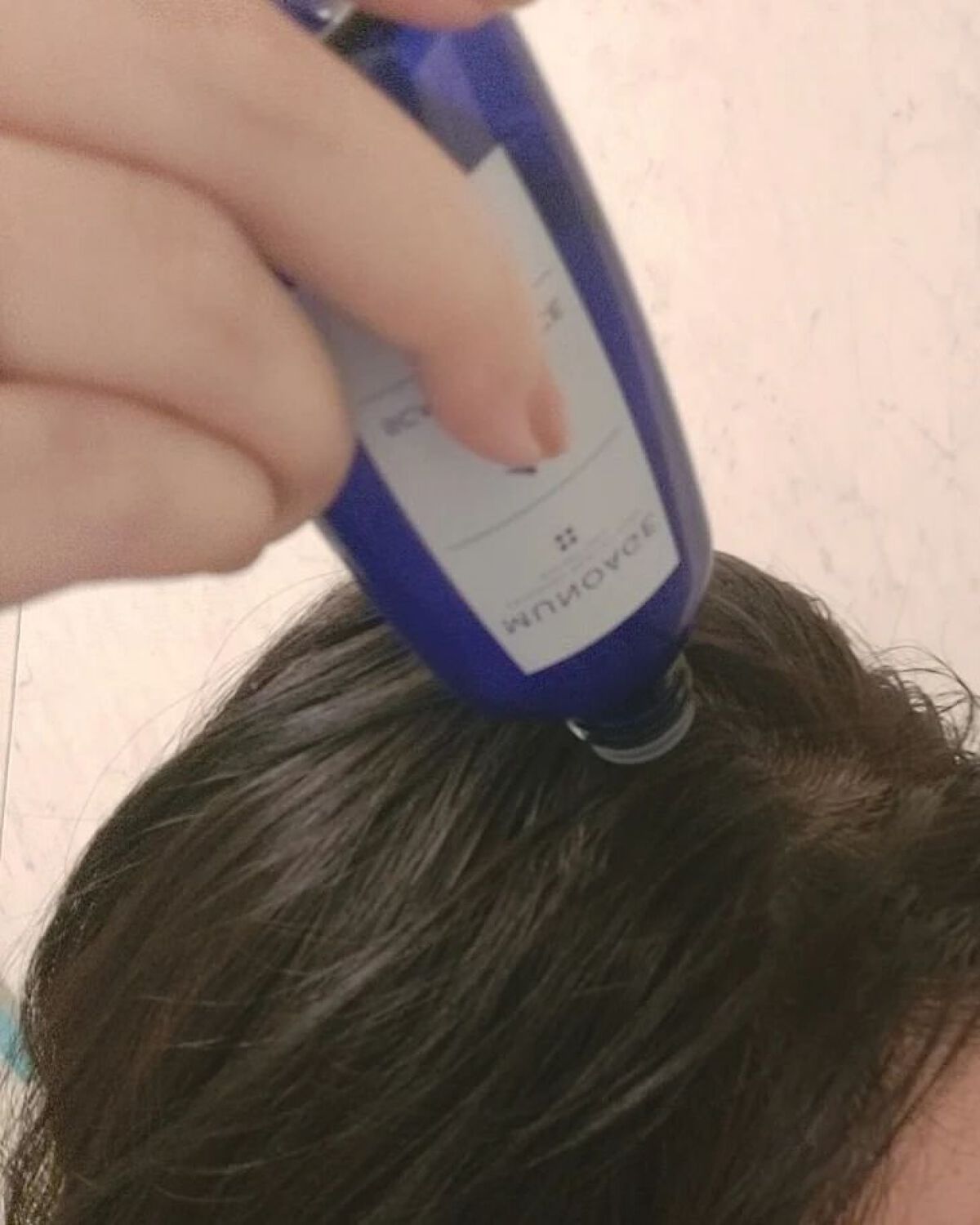 Wアプローチヘアプログラム/MUNOAGE(ミューノアージュ)/頭皮ローションを使ったクチコミ（2枚目）