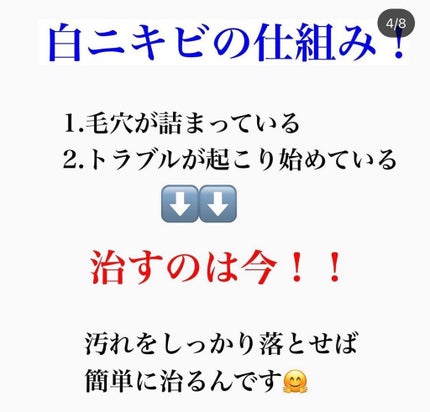 kento@パーソナルスキンケア on LIPS 「こんばんは!けんとです!ニキビケアは大事です!この冬は乾燥して..」(4枚目)