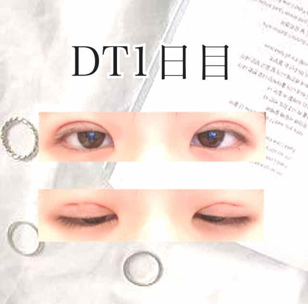 ð on LIPS ãäºéã«ãªããããŠããŸããªãã£ãã®ã§ã䞡芪ã説åŸãããŠå没ããŠã..ãïŒ3æç®ïŒ