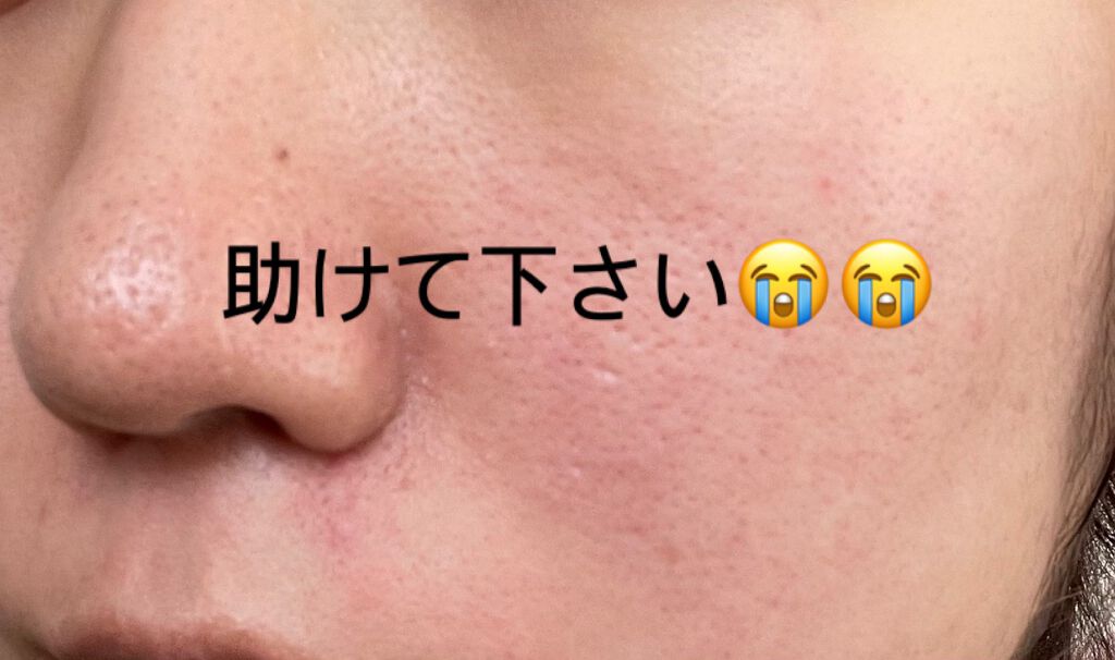 薬用しみ対策 美白化粧水/メラノCC/化粧水を使ったクチコミ（1枚目）