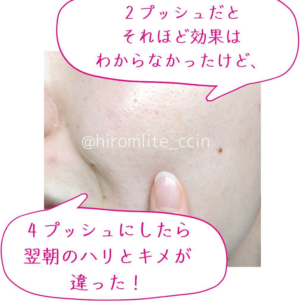 ダイレクトVCショットセラム/ルジュ/美容液を使ったクチコミ(3枚目)