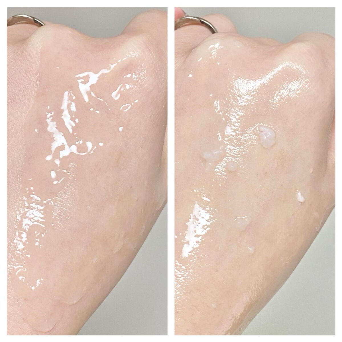 DETclear M. ピーリングジェリー/DET clear M/ピーリングを使ったクチコミ(7枚目)