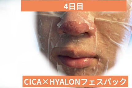 を使ったクチコミ(1枚目)