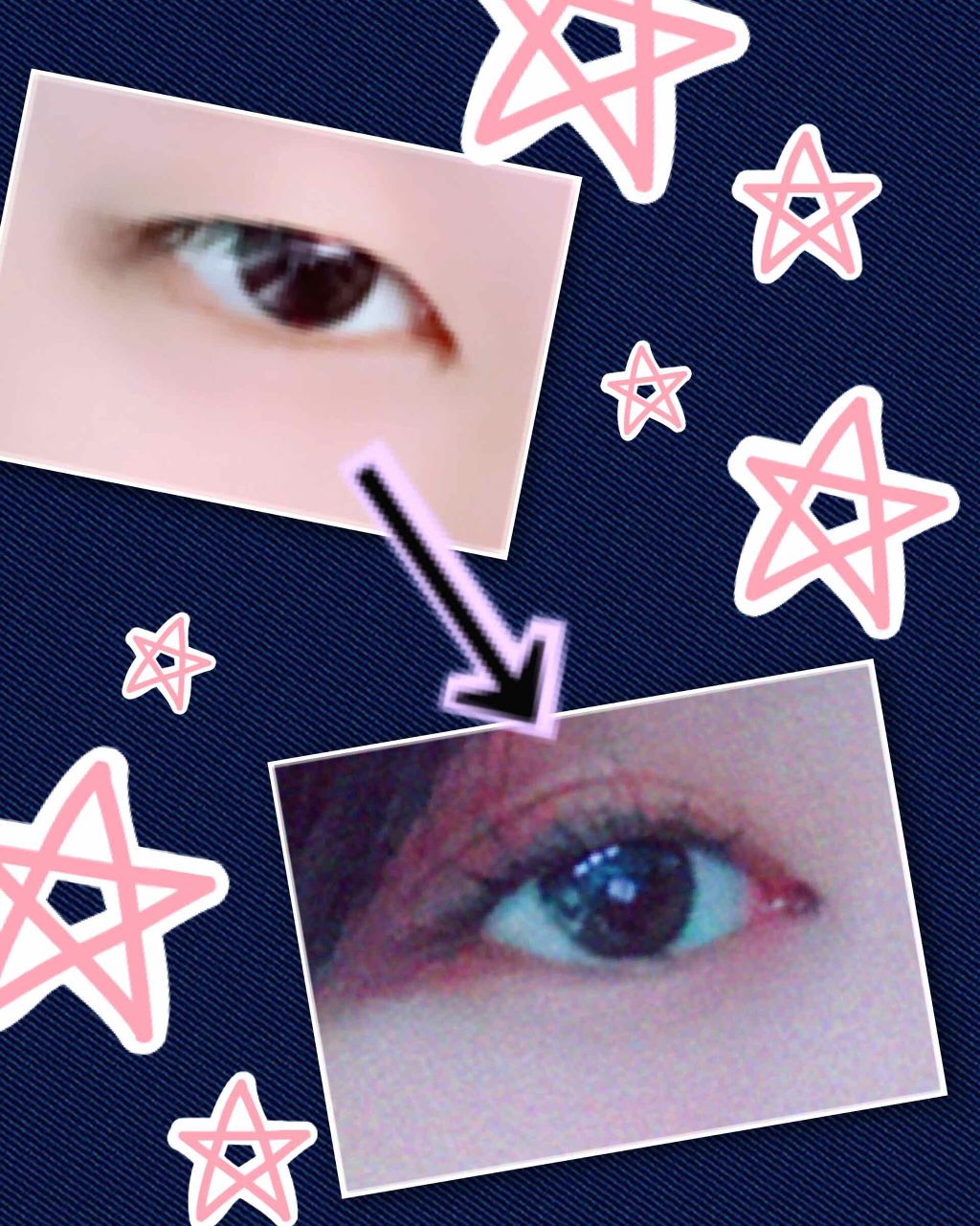 アイテープ(絆創膏タイプ、レギュラー、70枚)/DAISO/二重まぶた用アイテムを使ったクチコミ(1枚目)