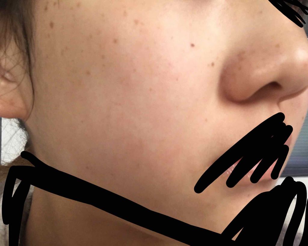 twinkle_rouge_zqs on LIPS 「中学位から顔のブスさにドン引きし始め少しでもと…やっと化粧水を..」(2枚目)