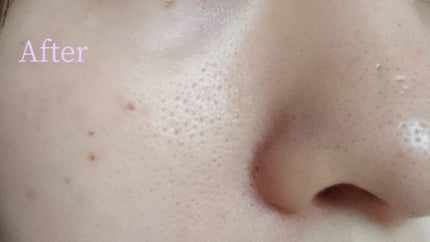 デュオ ザ クレンジングバーム ブラックリペア /DUO/クレンジングバームを使ったクチコミ(4枚目)