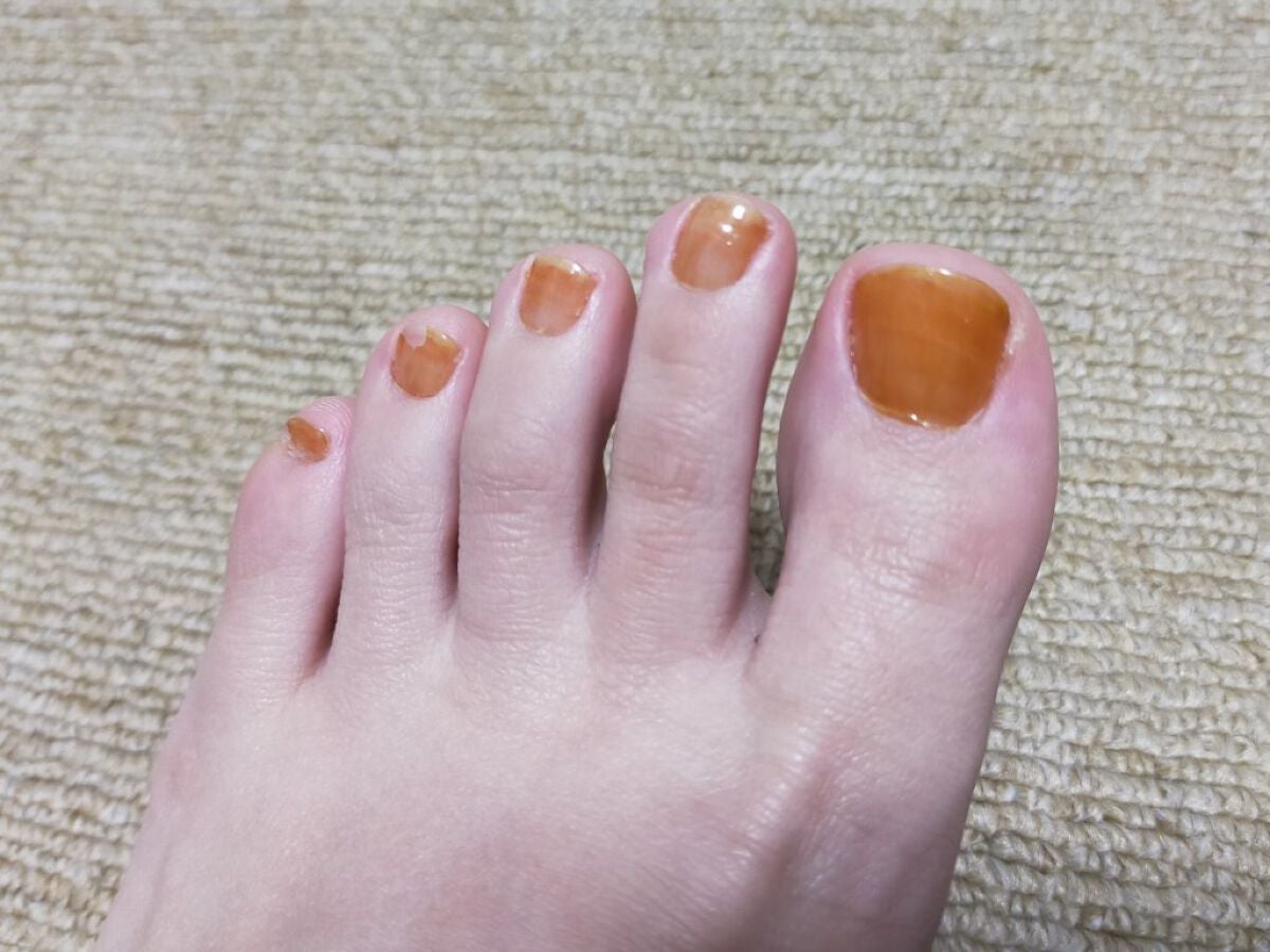 チャームスティックジェル/OMD/オールインワンネイルを使ったクチコミ(2枚目)