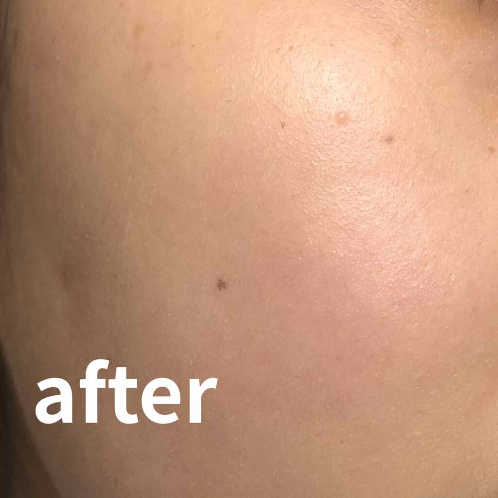 ドクタージャルト シカペア リカバー (第2世代)/Dr.Jart+/フェイスクリームを使ったクチコミ(3枚目)