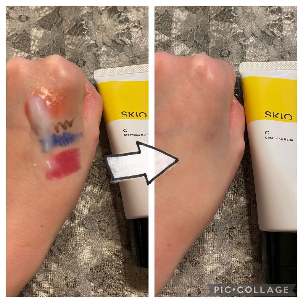 VC クレンジングバーム /SKIO/クレンジングバームを使ったクチコミ(4枚目)