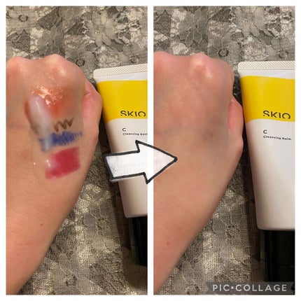 VC クレンジングバーム /SKIO/クレンジングバームを使ったクチコミ(4枚目)